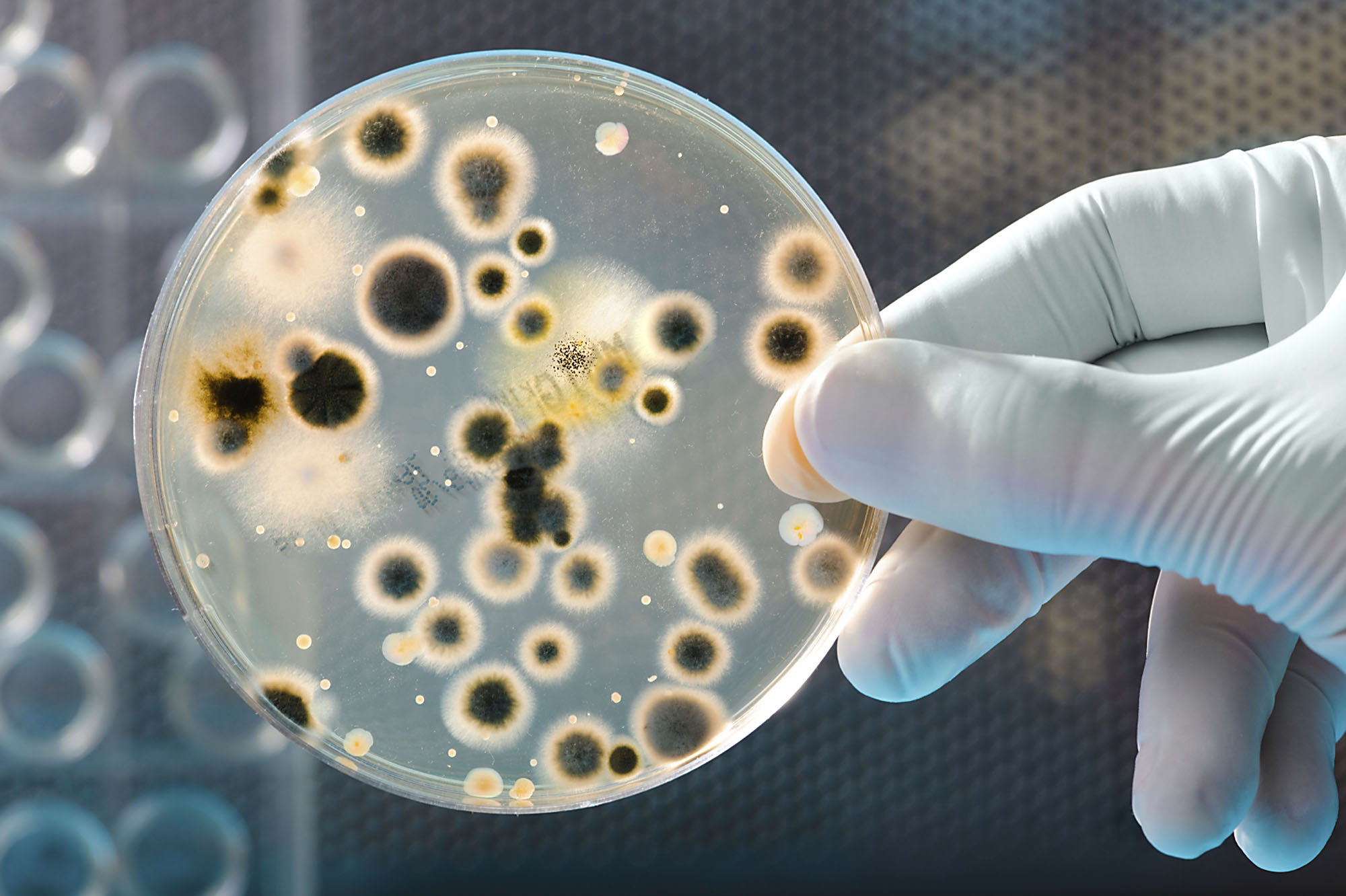 Bakteri Kültüründen Metisilin Dirençli Doğal Kaynaklı Hızlı Tanı Testi